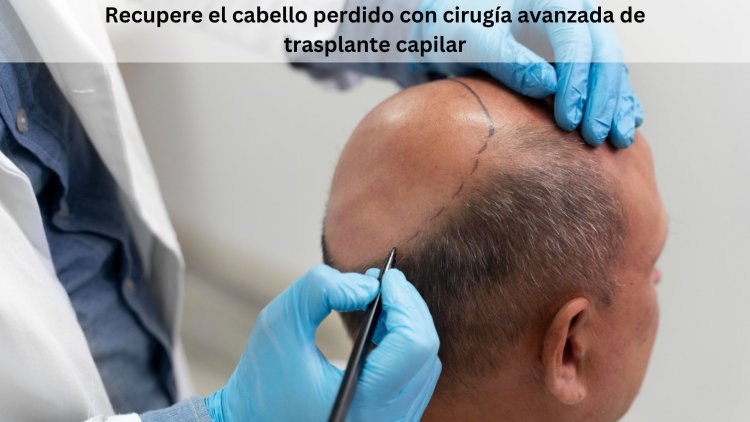 Recupere el cabello perdido con cirugía avanzada de trasplante capilar